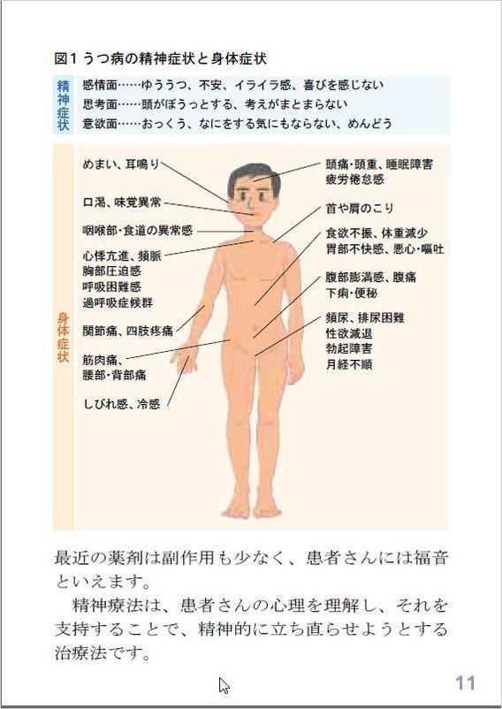 うつ関節痛.jpg
